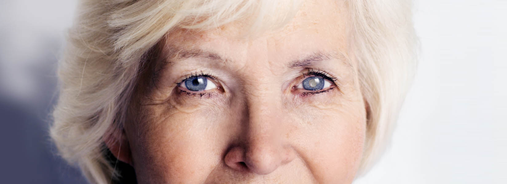 Cataract Surgery in Marion